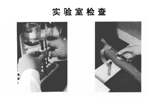 体检实验室检查是什么,有什么作用