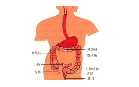 结肠癌是什么原因引起