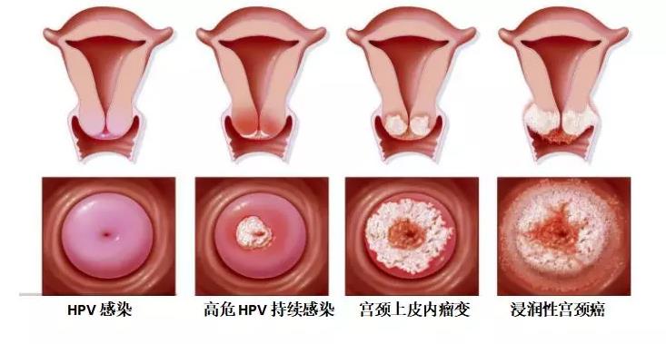 女性特别注意的五项妇科检查
