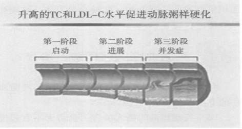 动脉血管的横切剖面图