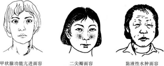 面容与健康状况有关系吗？